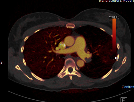Radiology Cat Scan Image